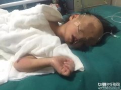 4岁女童跌入滚水，父母护理不当，烫伤面积反而扩大到42%！